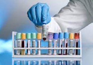 Mão com luva segurando tubo de coleta em um laboratório
